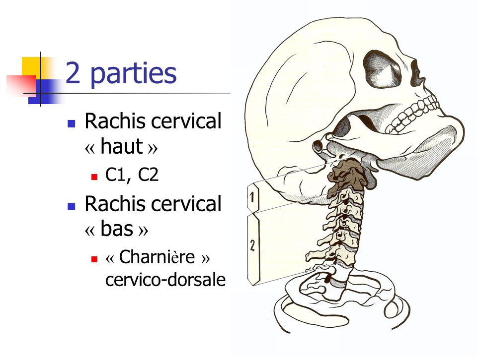 Que tomar para los mareos de cervicales